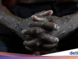 Makin Ngeri, Kematian Mpox ‘Cacar Monyet’ Di Afrika Sudah Lebih Bersama 800 Tindak Kejahatan