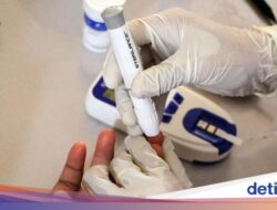 Daftar Layanan Pemeriksaan Kesejaganan Gratis Lengkap, Balita hingga Lansia