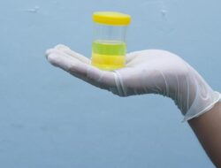 Praktisi Medis Ungkap Beda Busa Di Urine yang Normal Vs Tanda Ginjal Bermasalah