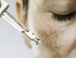 Peringatan Dermatolog, Sefatal Ini Efeknya Pakai Skincare Berkedok ‘Putih Instan’