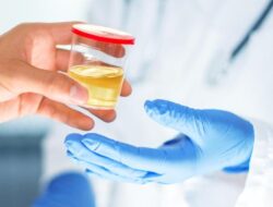 Cek Sekarang! Seperti Ini Warna Urine yang Menandakan Gagal Ginjal