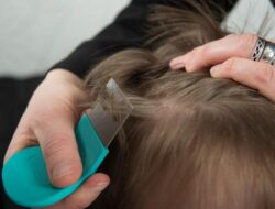 Selain Kebersihan, Kebiasaan Ini Juga Bisa Undang Kutu Hingga Rambut