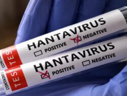 Heboh Kabar Warga Singapura Diduga Kena Hantavirus, Kemenkes Ungkap Hasil Tesnya