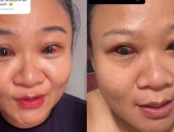 Viral Mata Ibu Memerah Usai Melahirkan, Obgyn Bagikan Cara Mengejan yang Aman
